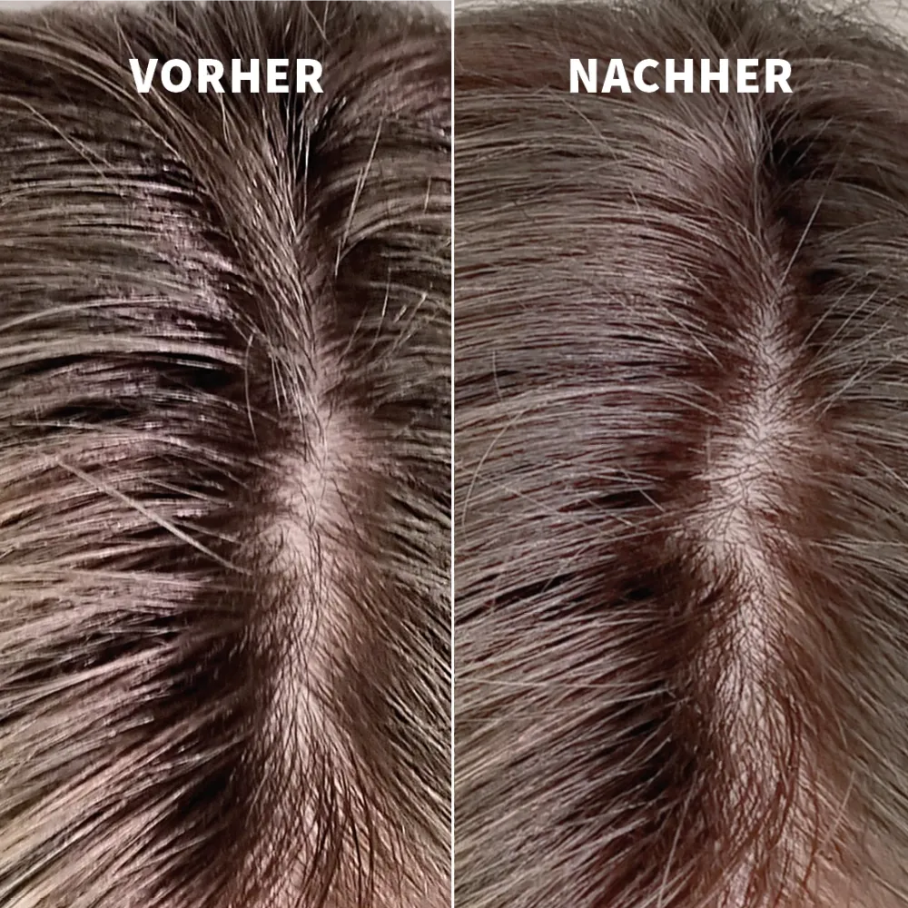 DRY FOAM SHAMPOO 200 ML